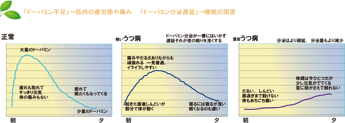 「ドーパミン不足」→筋肉の疲労感や痛み　　「ドーパミン分泌遅延」→睡眠の阻害